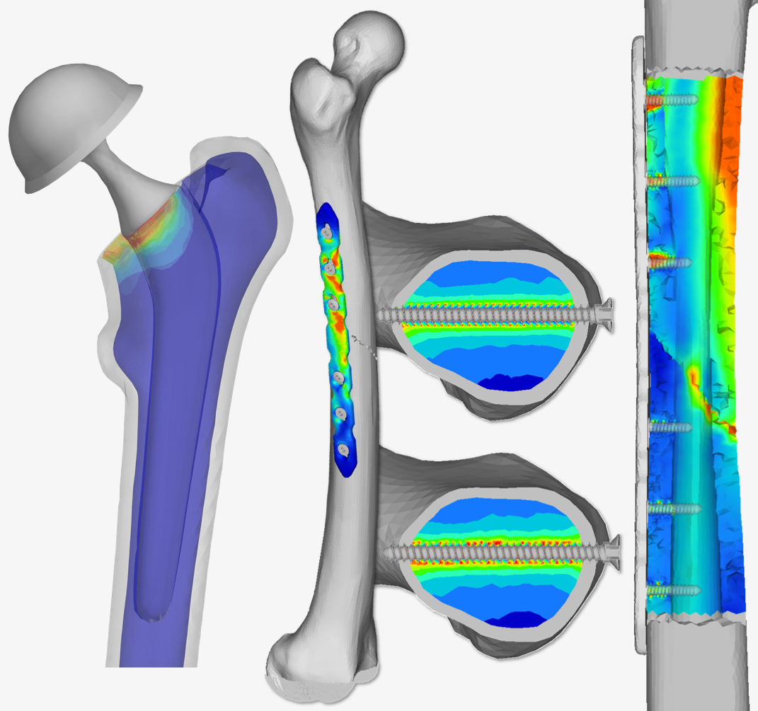 Philomec image